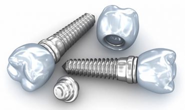 Her hastaya implant uygulanabilir mi?