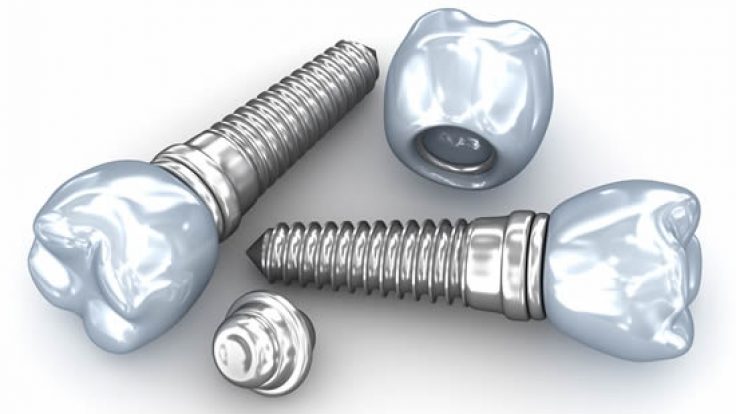 Her hastaya implant uygulanabilir mi?